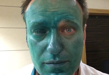 Алексею Навальному плеснули в лицо зелёнкой