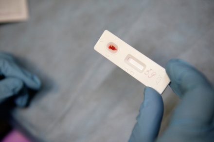 Иммунолог допустил распространение ВИЧ в рядах ВСУ после мобилизации ограниченно годных