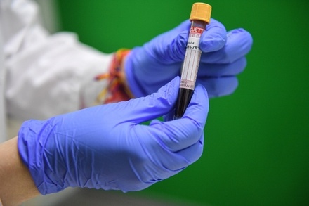 Иммунолог призвал россиян сдавать тест на антитела к коронавирусу дважды