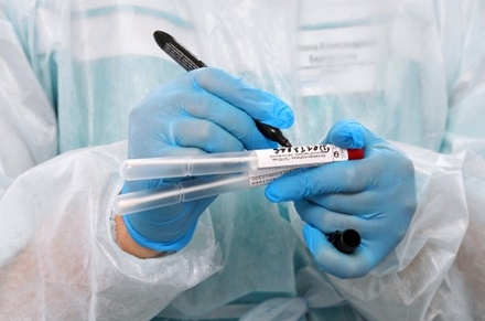 Москва лидирует среди мегаполисов по количеству тестов на коронавирус