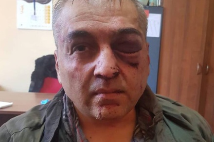 Напавшим на банк в Ереване оказался полковник полиции