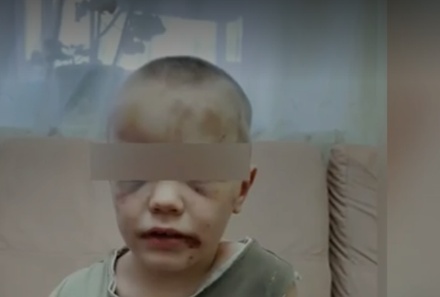 Медики Новороссийска рассказали о состоянии найденного в затопленной квартире ребёнка