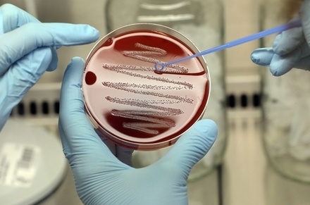 Инфекционист связал появление новых болезней с использованием антибиотиков в сельском хозяйстве