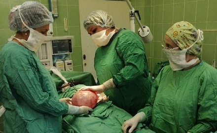 Подмосковные врачи удалили 43-летней пациентке гигантскую опухоль яичника