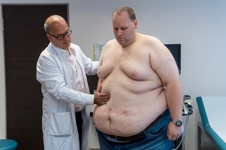 Эндокринолог назвала основные причины ожирения: не гормоны, а образ жизни
