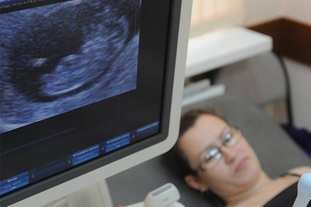 Минздрав установил медицинские показания для аборта