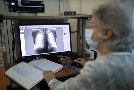 Главный фтизиатр Минздрава заявила о спаде заболеваемости туберкулёзом в России