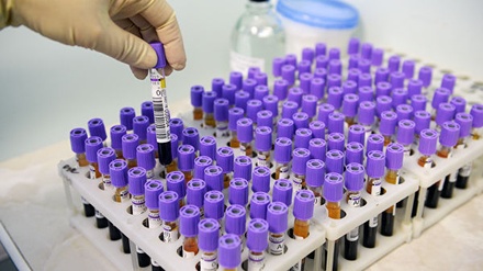 Амурские власти отрицают массовое заражение онкобольных детей гепатитом C