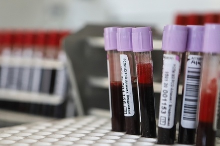 Москва оказалась под угрозой дефицита донорской крови