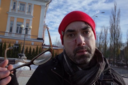 В Оттаве выразили возмущение нападением на канадского журналиста в Киеве