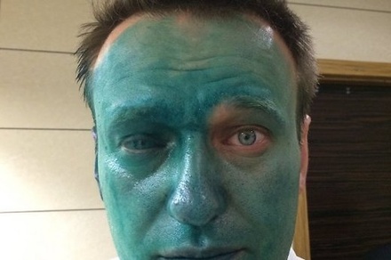 Алексей Навальный рассказал о риске частичной потери зрения после нападения