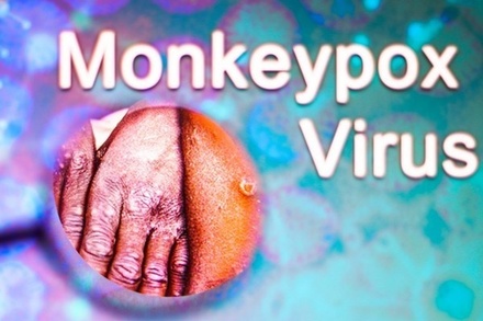 Вирусолог счёл абсурдным причисление оспы обезьян к венерическим заболеваниям