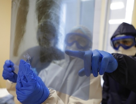 В НИИ Склифосовского заявили о развитии тромбоза из-за COVID-19