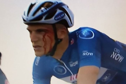 Украинский велогонщик разбил лицо сопернику на многодневке «Тур Дубая»