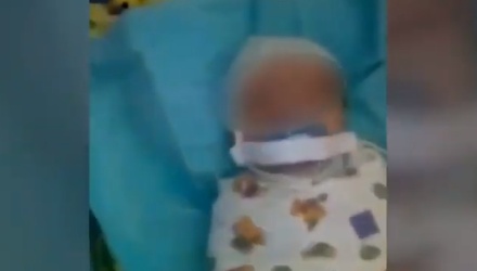 Врачи выяснили, кто заклеил рот младенцу пластырем в роддоме в Ингушетии