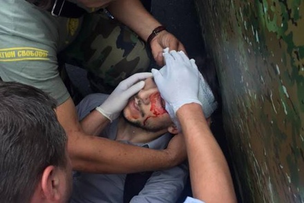 Журналист французского издания Finance ранен в ходе беспорядков у здания Рады