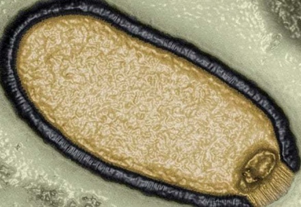 Учёные предупредили о возможной пандемии из-за сибирских зомби-вирусов
