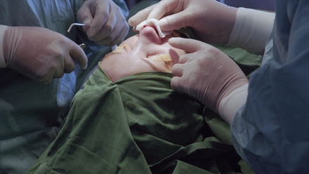 Лор-врач: искривления носовой перегородки чаще встречаются у дерущихся мужчин