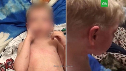 СКР возбудил дело после избиения четырёхлетнего мальчика в Омске