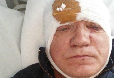 В Подмосковье жителю СНТ соседи разбили голову битой из-за замечания о фейерверке